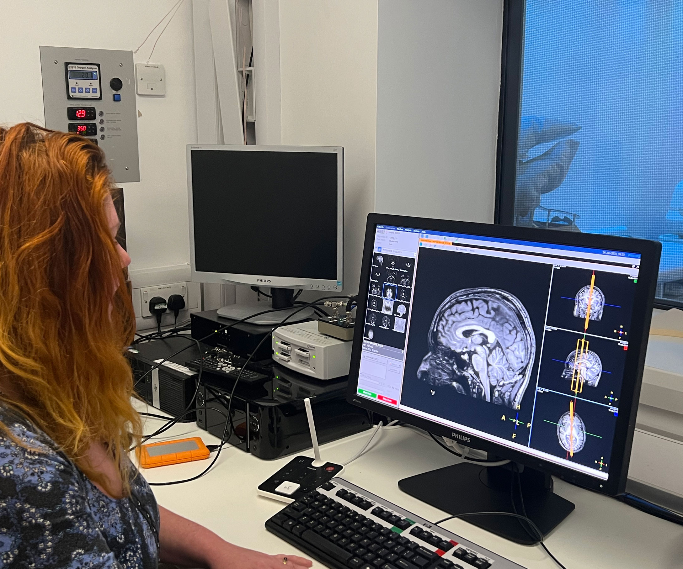 噪音暴露的研究可能为耳鸣带来新启示