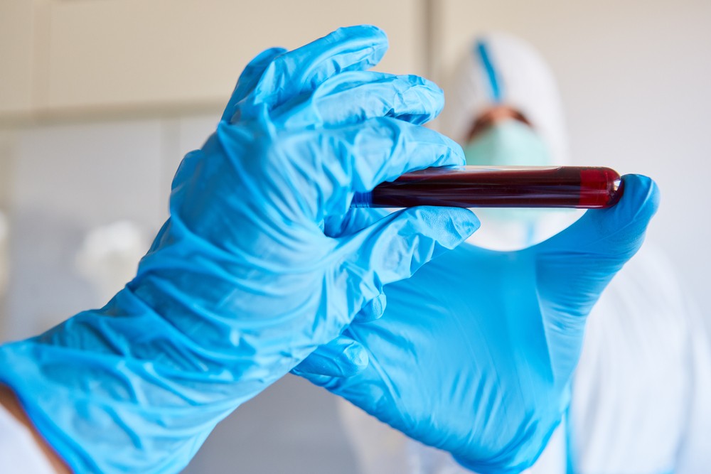 全球18个国家的500多名科学家将对患者血液中的COVID-19效果和治疗进行研究