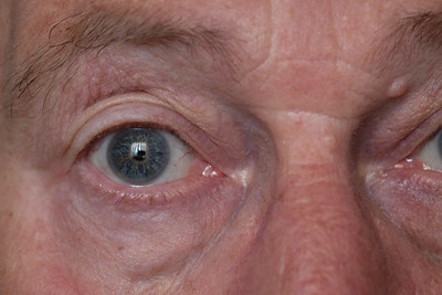 与最常见的失明原因密切相关的蛋白质