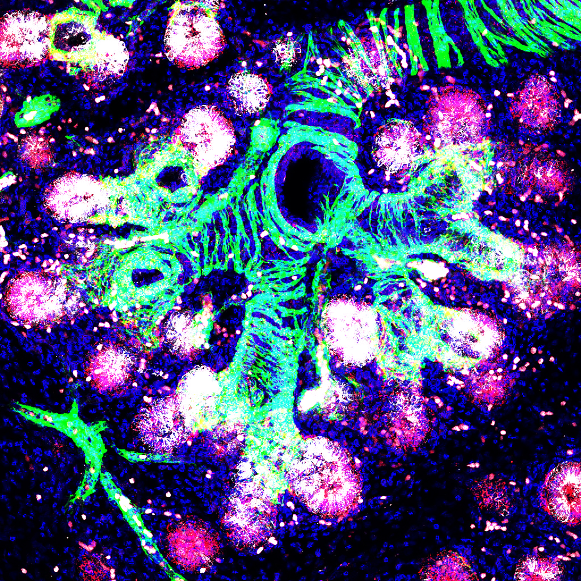 揭示肺健康基因最大突破，为个性化风险评分铺平道路