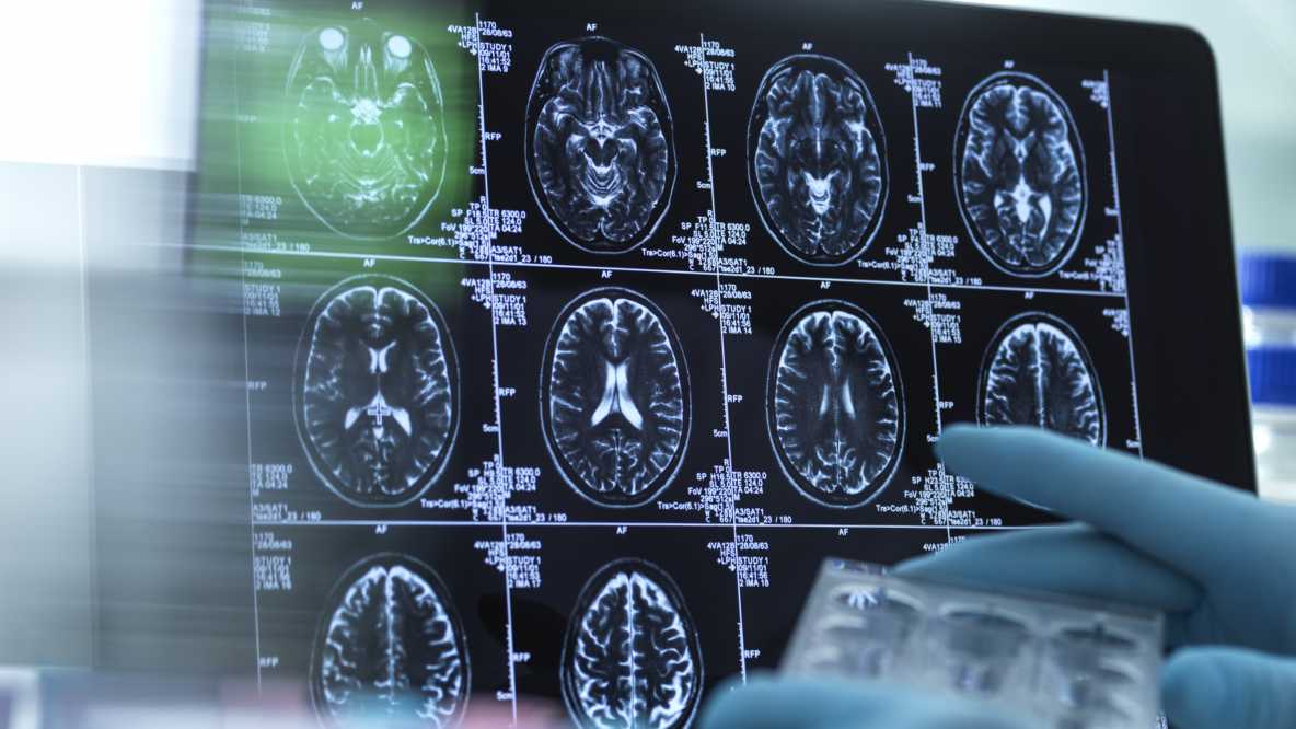 谢菲尔德医疗健康研究者获得1200万英镑资助，加速科学发现转化为新的医疗治疗方案