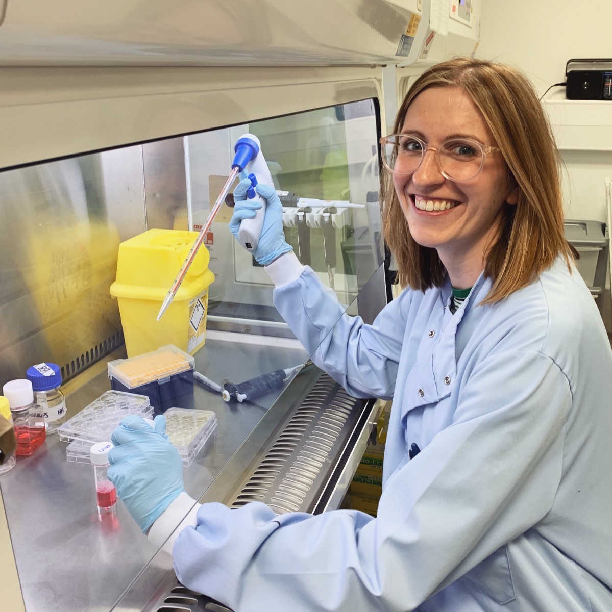 研究表明，类风湿药物可能被重新利用，帮助防止乳腺癌转移到骨头中。