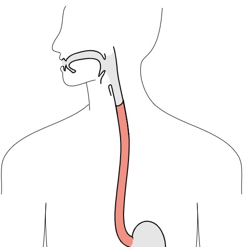 研究开辟了一种新的预防癌前症关怀方式