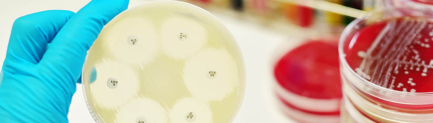 曼彻斯特科学家利用基因编辑技术生产新抗生素 曼彻斯特科学家利用基因编辑技术生产新抗生素