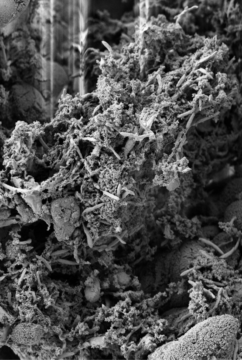 抗生素是可避免的肠道疾病诱因