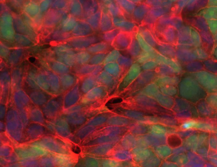 雪医学研究基金会捐赠800万美元，旨在提高乳腺癌患者的预后效果