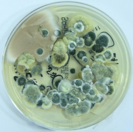 研究显示，暴露在霉菌环境中明显增加慢性阻塞性肺病（COPD）发作的机会。