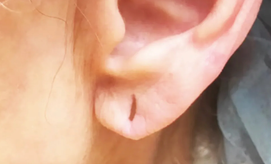 elongated ear piercing